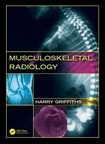 Паперова книга «Musculoskeletal Radiology», автор Гаррі Гріффітс - фото №1
