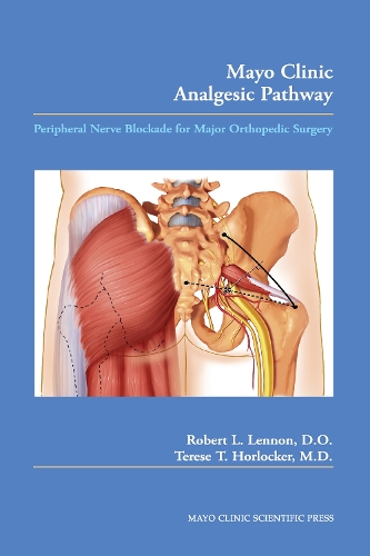 Бумажная книга «Mayo Clinic Analgesic Pathway: Peripheral Nerve Blockade for Major Orthopedic Surgery», авторов Роберт Л. Леннон, Тереза Т. Хорлокер - фото №1