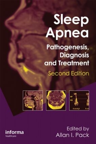 Бумажная книга «Sleep Apnea: Pathogenesis, Diagnosis and Treatment» - фото №1
