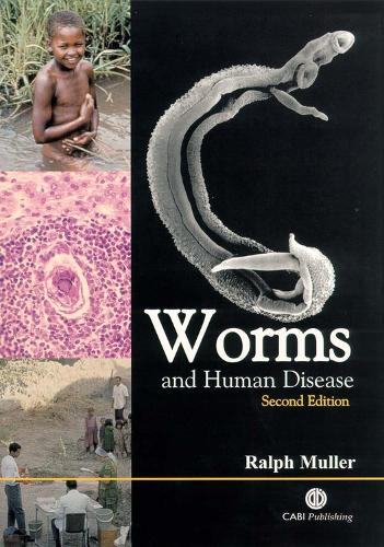 Бумажная книга «Worms and Human Disease», автор Ральф Мюллер - фото №1