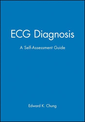 Паперова книга «ECG Diagnosis: A Self-Assessment Guide», автор Едвард К. Чанг - фото №1