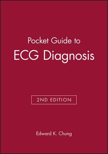 Бумажная книга «Pocket Guide to ECG Diagnosis», автор Эдвард К. Чанг - фото №1