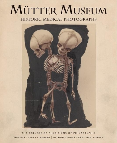 Бумажная книга «Mütter Museum Historic Medical Photographs», автор Колледж врачей Филадельфии - фото №1