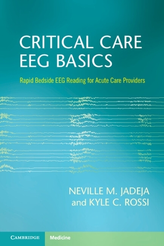 Бумажная книга «Critical Care EEG Basics: Rapid Bedside EEG Reading for Acute Care Providers», авторов Кайл К. Росси, Невилл М. Джадеха - фото №1