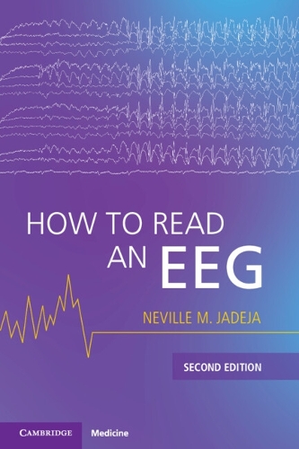 Бумажная книга «How to Read an EEG», автор Невилл М. Джадеха - фото №1
