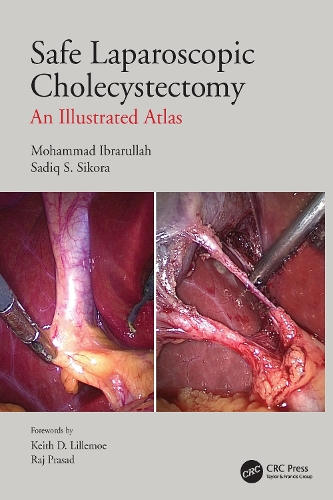 Бумажная книга «Safe Laparoscopic Cholecystectomy: An Illustrated Atlas», авторов Мохаммад Ибрарулла, Садик С. Сикора - фото №1