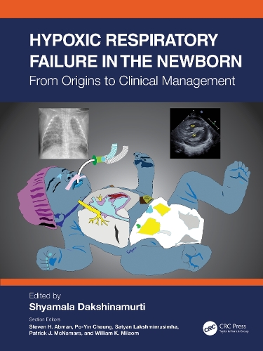 Паперова книга «Hypoxic Respiratory Failure in the Newborn: From Origins to Clinical Management» - фото №1