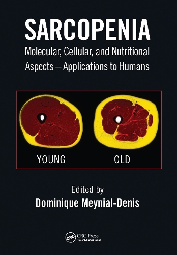 Бумажная книга «Sarcopenia: Molecular, Cellular, and Nutritional Aspects – Applications to Humans» - фото №1