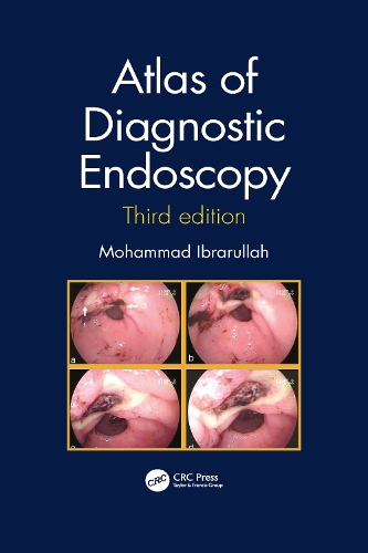 Бумажная книга «Atlas of Diagnostic Endoscopy, 3E», автор Мохаммад Ибрарулла - фото №1
