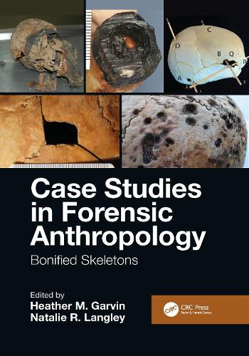 Паперова книга «Case Studies in Forensic Anthropology: Bonified Skeletons» - фото №1