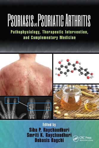 Паперова книга «Psoriasis and Psoriatic Arthritis: Pathophysiology, Therapeutic Intervention, and Complementary Medicine» - фото №1
