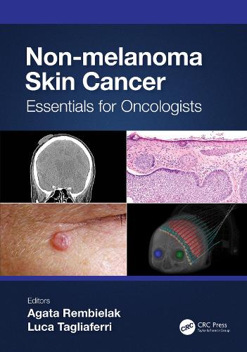 Бумажная книга «Non-melanoma Skin Cancer: Essentials for Oncologists» - фото №1