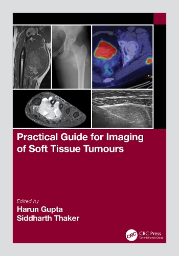 Бумажная книга «Practical Guide for Imaging of Soft Tissue Tumours» - фото №1