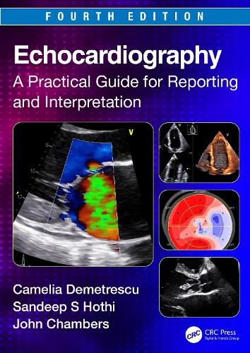 Паперова книга «Echocardiography: A Practical Guide for Reporting and Interpretation», авторів Камелія Деметреску, Сандіп С. Хоті - фото №1