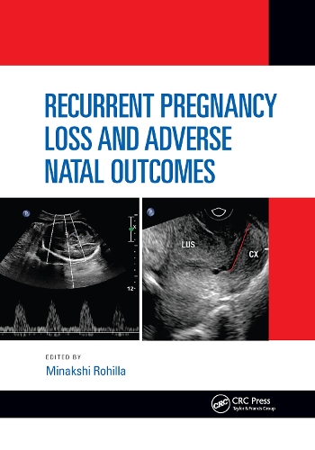 Паперова книга «Recurrent Pregnancy Loss and Adverse Natal Outcomes» - фото №1