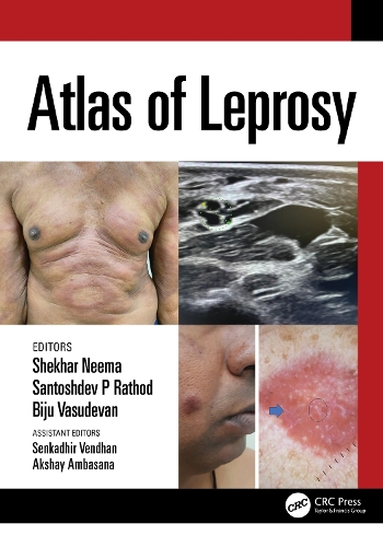 Бумажная книга «Atlas of Leprosy» - фото №1