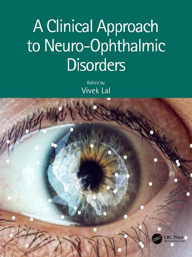 Паперова книга «A Clinical Approach to Neuro-Ophthalmic Disorders» - фото №1