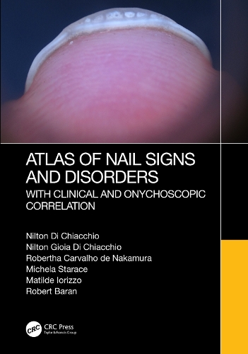 Бумажная книга «Atlas of Nail Signs and Disorders with Clinical and Onychoscopic Correlation», авторов Матильда Иориццо, Микела Стараче, Нилтон Ди Кьяккио, Нилтон Джойя Ди Кьяккио, Роберт Баран, Роберта Карвальо де Накамура - фото №1