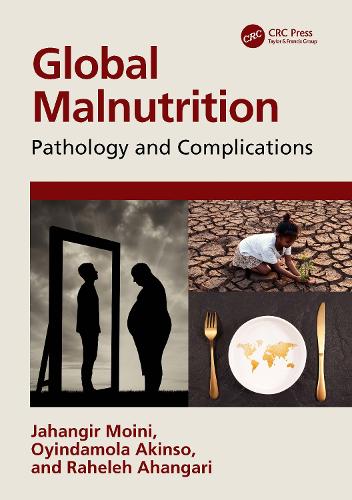 Бумажная книга «Global Malnutrition: Pathology and Complications», авторов Джахангир Мойни, Ойиндамола Акинсо, Рахелех Ахангари - фото №1