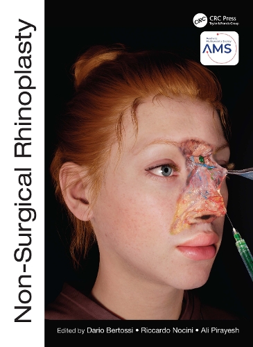 Паперова книга «Non-Surgical Rhinoplasty» - фото №1
