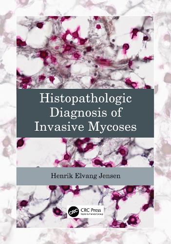Бумажная книга «Histopathologic Diagnosis of Invasive Mycoses», автор Хенрик Элванг Йенсен - фото №1