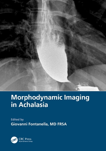 Бумажная книга «Morphodynamic Imaging in Achalasia» - фото №1