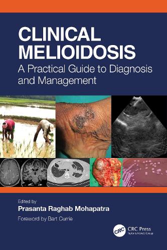 Бумажная книга «Clinical Melioidosis: A Practical Guide to Diagnosis and Management» - фото №1