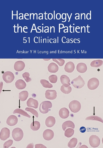 Бумажная книга «Haematology and the Asian Patient: 51 Clinical Cases», авторов Анскар Ю.Х. Люн, Эдмонд С К Ма - фото №1