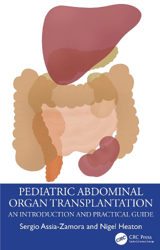 Паперова книга «Pediatric Abdominal Organ Transplantation: An Introduction and Practical guide», авторів Найджел Хітон, Серхіо Ассіа-Замора - фото №1
