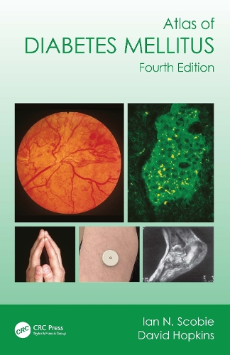 Бумажная книга «Atlas of Diabetes Mellitus», автор Ян Н. Скоби - фото №1
