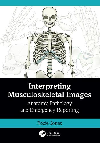 Паперова книга «Interpreting Musculoskeletal Images: Anatomy, Pathology and Emergency Reporting», автор Розі Джонс - фото №1