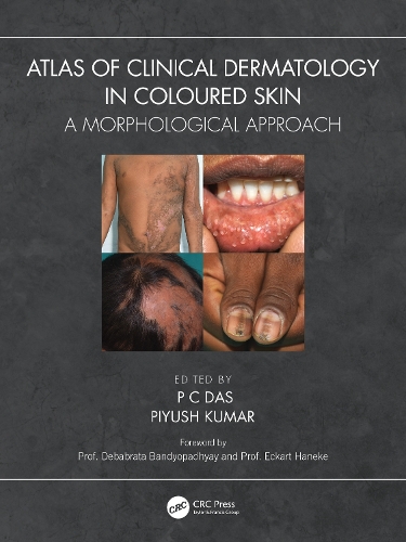 Паперова книга «Atlas of Clinical Dermatology in Coloured Skin: A Morphological Approach» - фото №1