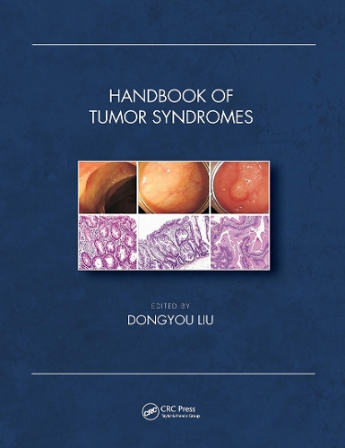 Бумажная книга «Handbook of Tumor Syndromes» - фото №1