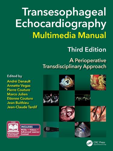 Паперова книга «Transesophageal Echocardiography Multimedia Manual: A Perioperative Transdisciplinary Approach» - фото №1