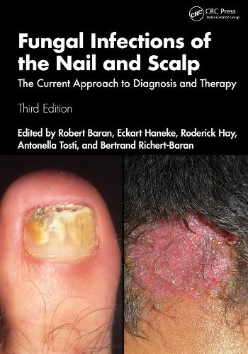 Паперова книга «Fungal Infections of the Nail and Scalp: The Current Approach to Diagnosis and Therapy» - фото №1