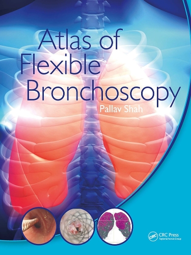 Паперова книга «Atlas of Flexible Bronchoscopy», автор Паллав Шах - фото №1