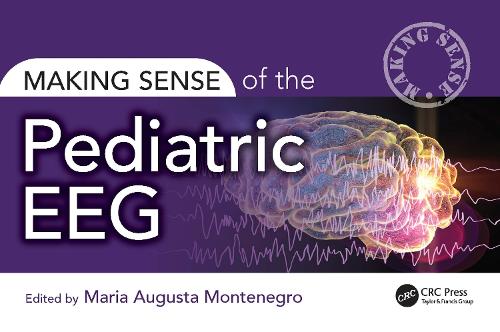 Бумажная книга «Making Sense of the Pediatric EEG» - фото №1