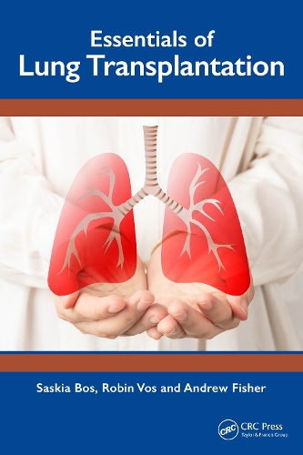 [object Object] «Essentials of Lung Transplantation», автор Саския Бос - фото №1