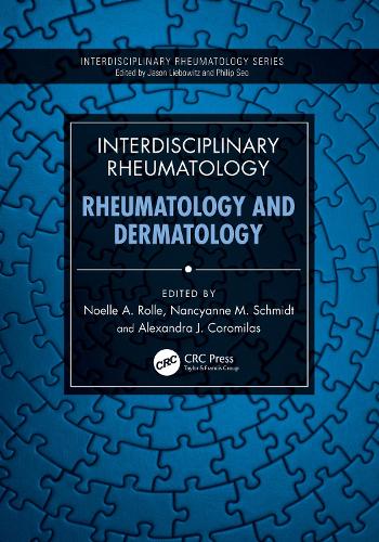 Бумажная книга «Interdisciplinary Rheumatology: Rheumatology and Dermatology» - фото №1