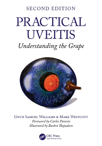 Паперова книга «Practical Uveitis: Understanding the Grape», авторів Гвін Семюель Вільямс, Марк Весткотт - фото №1