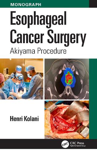 Бумажная книга «Esophageal Cancer Surgery: Akiyama Procedure», автор Анри Колани - фото №1