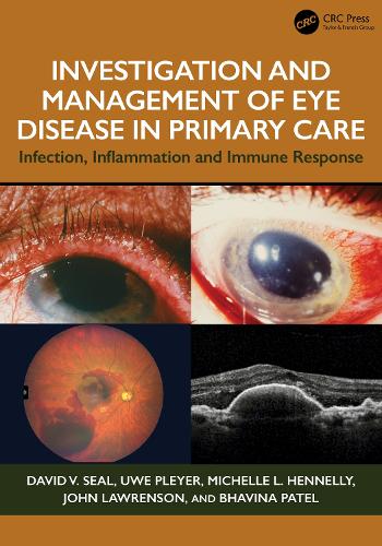 Бумажная книга «Investigation & Management of Eye Disease in Primary Care: Infection, Inflammation and Immune Response», авторов Дэвид В. Сил, Уве Плейер - фото №1