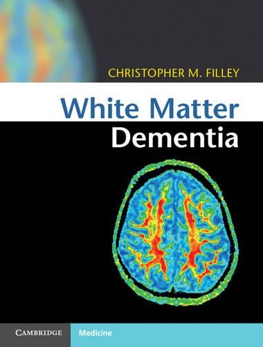 Паперова книга «White Matter Dementia», автор Крістофер М. Філлі - фото №1
