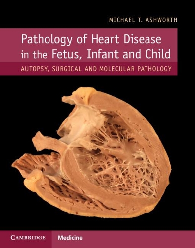 Паперова книга «Pathology of Heart Disease in the Fetus, Infant and Child: Autopsy, Surgical and Molecular Pathology», автор Майкл Т. Ешворт - фото №1