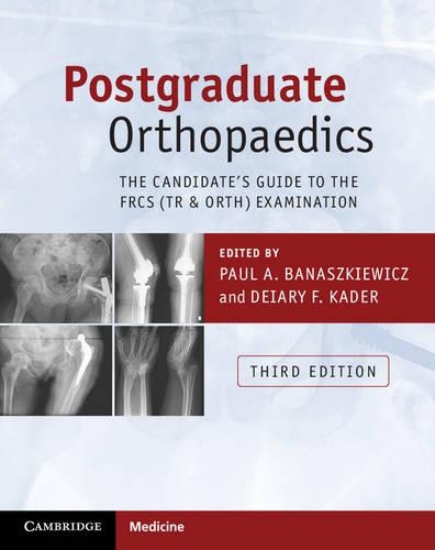 Бумажная книга «Postgraduate Orthopaedics: The Candidate's Guide to the FRCS (Tr & Orth) Examination» - фото №1