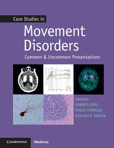 Бумажная книга «Case Studies in Movement Disorders: Common and Uncommon Presentations», авторов Кайлаш П. Бхатия, Мария Стамелу, Роберто Эрро - фото №1