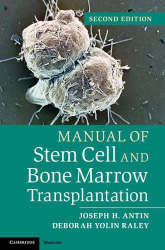 Паперова книга «Manual of Stem Cell and Bone Marrow Transplantation», авторів Дебора Йолін Рейлі, Джозеф Х. Антін - фото №1
