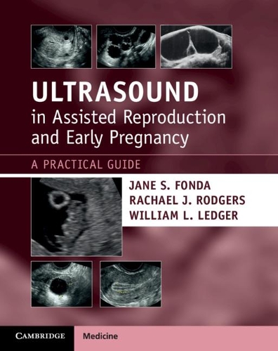 Бумажная книга «Ultrasound in Assisted Reproduction and Early Pregnancy: A Practical Guide», авторов Джейн С. Фонда, Рэйчел Дж. Роджерс - фото №1