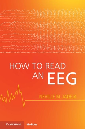 Бумажная книга «How to Read an EEG», автор Невилл М. Джадеха - фото №1