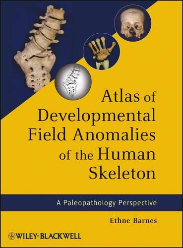 Паперова книга «Atlas of Developmental Field Anomalies of the Human Skeleton: A Paleopathology Perspective», автор Етне Барнс - фото №1